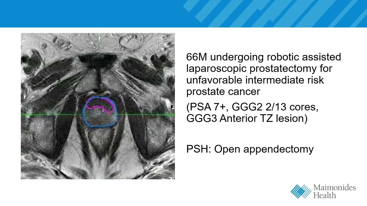 Core Videos (2022): Multiport Robot Docking
