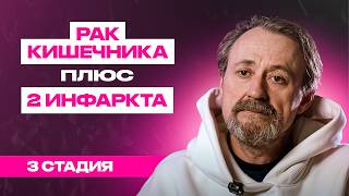 Научился жить со стомой – Роман Гудков, рак кишечника