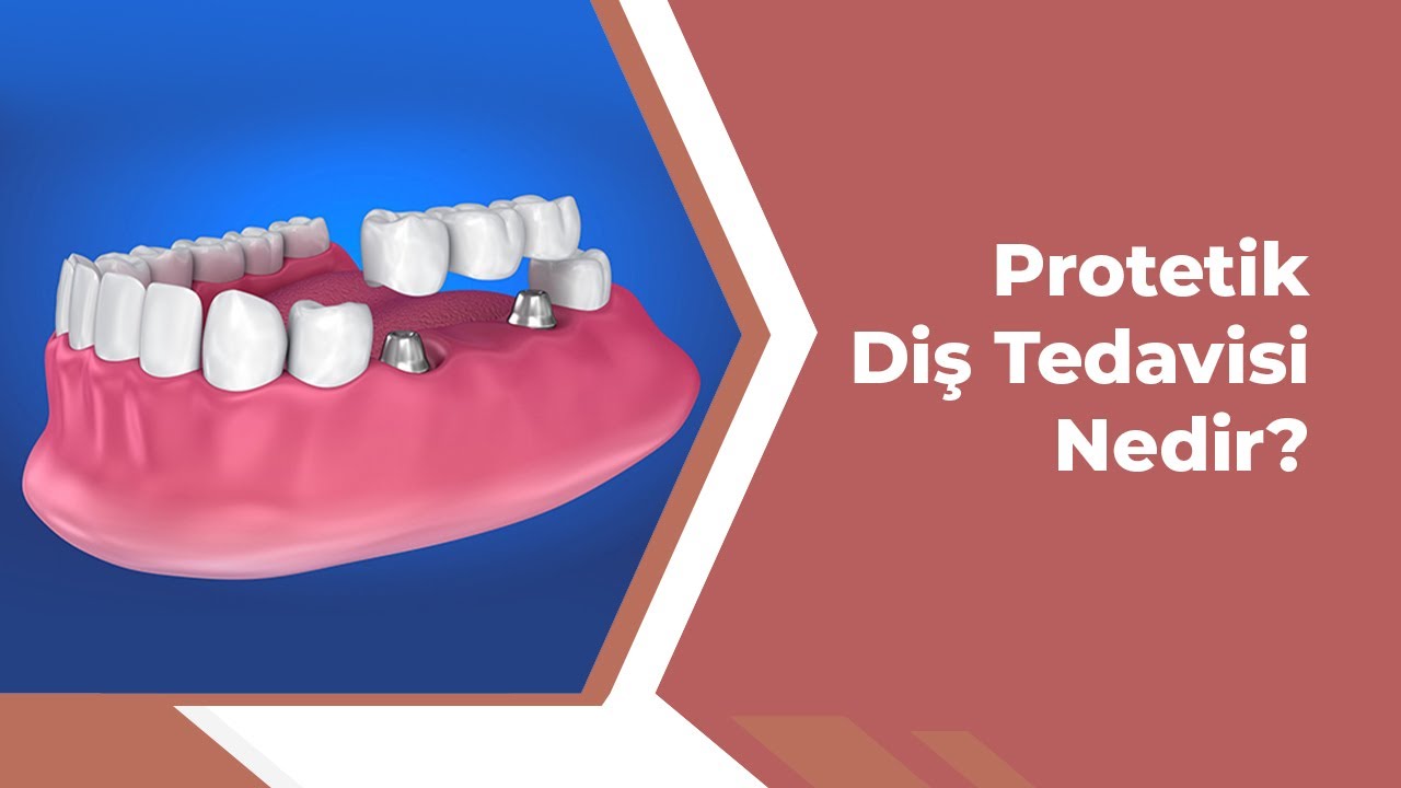 Protetik Diş Tedavisi Nedir? YouTube