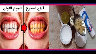 وصفة زيت النعناع و الجنزبيل تعطيك جمال غير طبيعي للاسنان !!