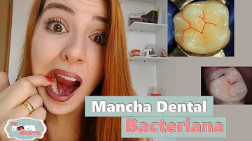 Como tratar sulco pigmentado?