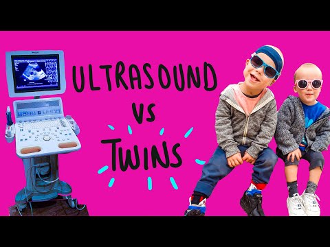 Who will win? Braving scans for our two boys with a rare syndrome