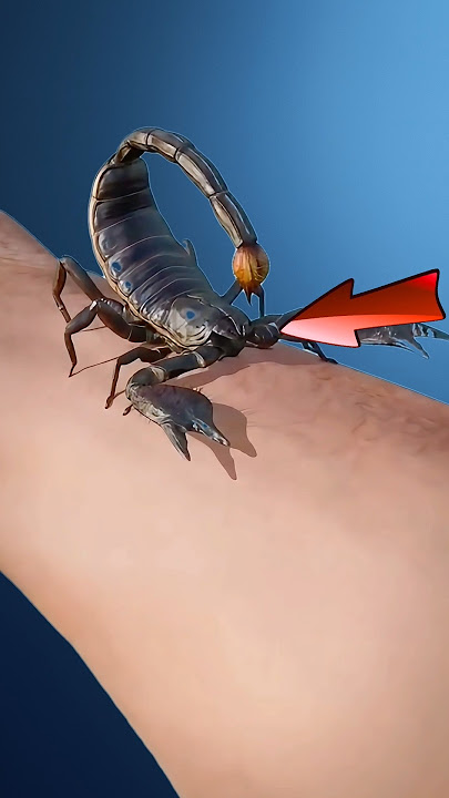 🦂 What to Do if a Scorpion Stings You?Red Scorpion Warning!#ScorpionSting #FirstAidTips #AIEducation