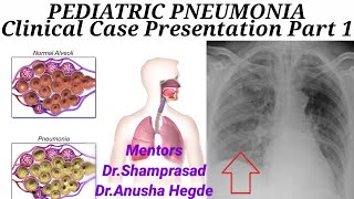 PEDIATRIC PNEUMONIA (Part 1) Clinical Case Presentation