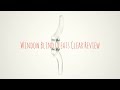 Amazon Clear Window Cord Cleat ► Window Cord Cleat Unboxing ◄ Drapery Cord Safety Cleat Amazon Clear Window Cord Cleat ► Window Cord Cleat Unboxing ◄ Drapery Cord Safety Cleat