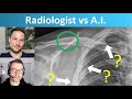 Radiologist vs Artificial Intelligence Ep.02 - Fracture Detection