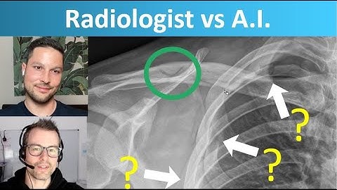 Radiologist vs Artificial Intelligence - Fracture Detection