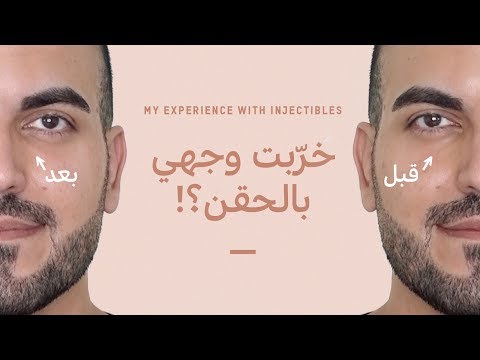 تجاربي مع الفيلر والبوتكس حقن الفيلر تحت العين علاج التجاعيد