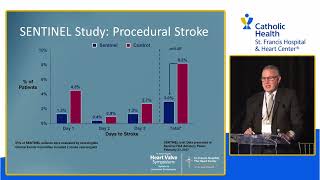 Era of Ceberal Protection in TAVR: George Petrossian, MD