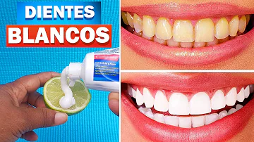 ¿Cómo blanquear los dientes en 3 minutos con bicarbonato?