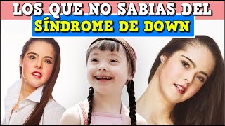 Sindrome de down - curiosidades que no sabias