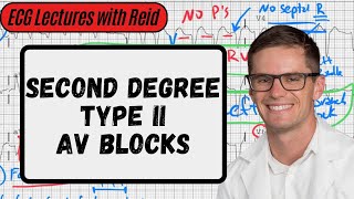 2nd Degree Type II AV Blocks | Day 6 ECG Challenge