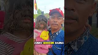 😱 YÜZÜN KILLARLA Kaplanırsa Ne Yapmalısın! 🧔