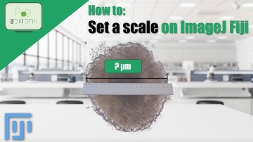 Get Perfect Results Every Time: How to Set the Scale in ImageJ Fiji for Flawless Measurements!