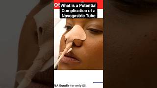 What is a Complication of a NG Tube?
