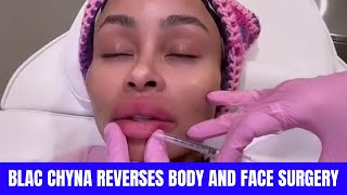 Blac Chyna Gets Face & Lips Implants Removed After Removing Silicone