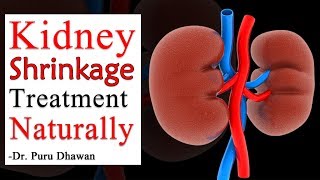 Kidney Shrinkage Treatment Naturally | How to improve shrink kidney naturally