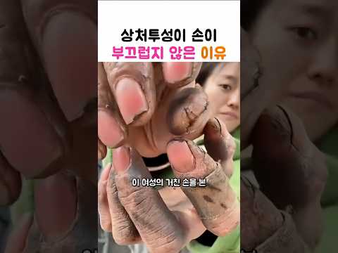 상처투성이 손이 부끄럽지 않은 이유 thumbnail
