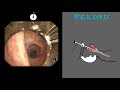 Bronchoscopy for Thoracic Surgery 2019