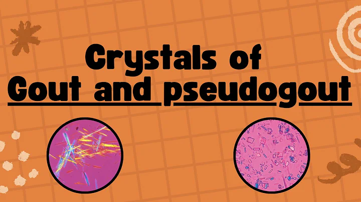 Difference between Gout and Pseudogout