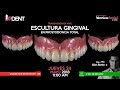 Escultura Gingival en Prostodoncia Total