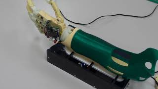 #HCT #ETS #SDP 201820 #AAM #Prosthetic Hand (Bionic Hand) screenshot 5