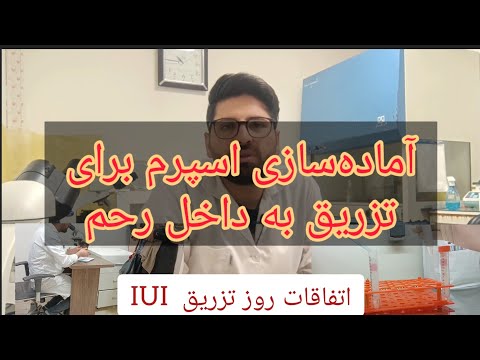 آماده سازی اسپرم برای تزریق به داخل رحم  شستشوی اسپرم روز تزریق اسپرم  