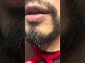 Despues del Minoxidil como aplico aceite de Aguacate 🥑 #beard #barba #minoxidil | Dia 74 de 365