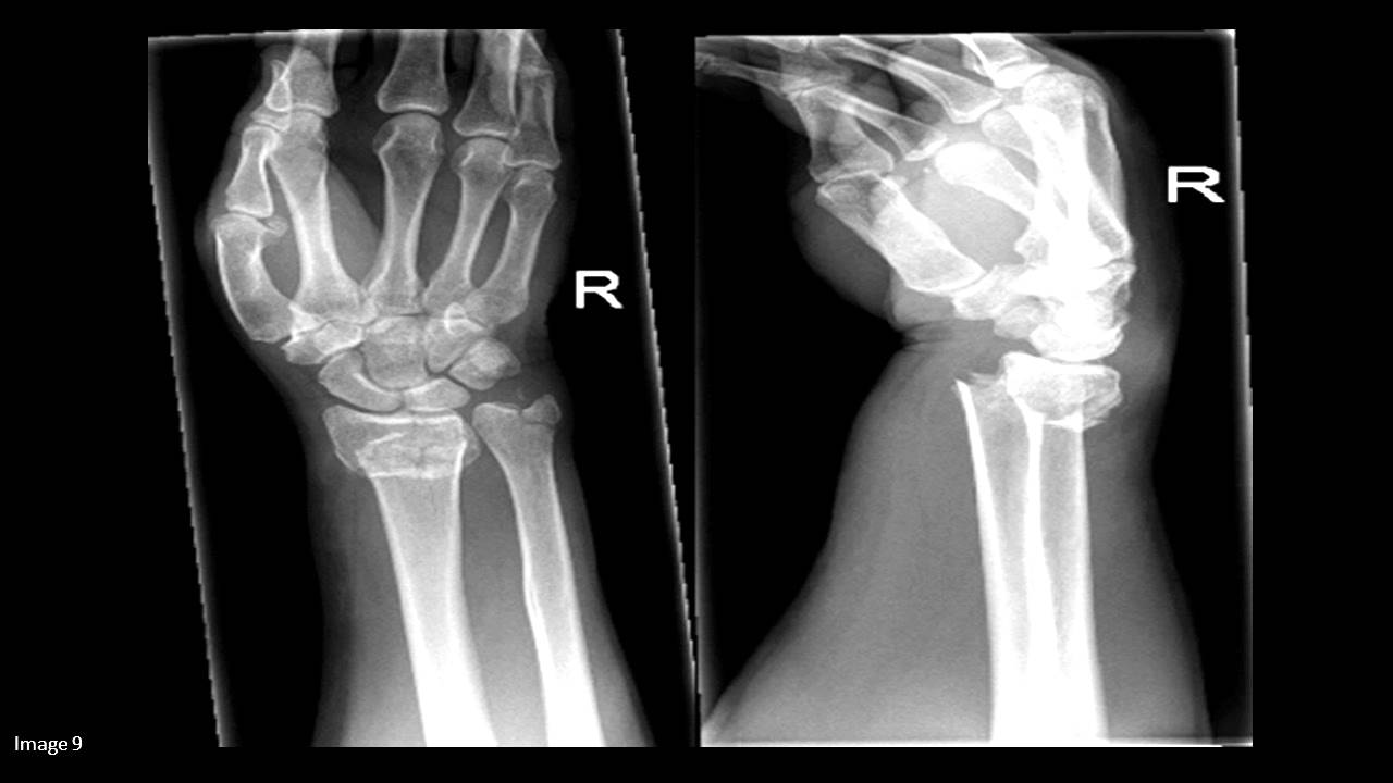 Orthopedic Surgeon X Rays