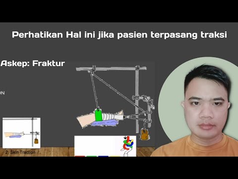 Video: 3 Cara Memakai Traksi Kulit