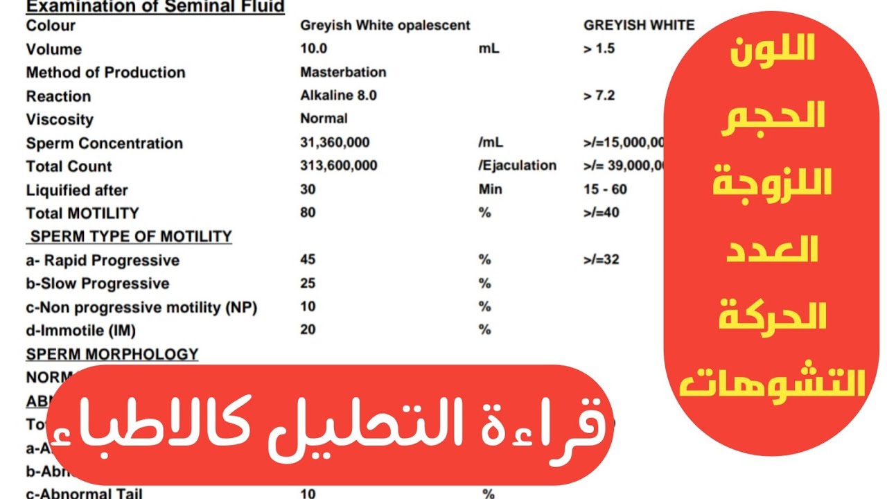 قراءة تحليل السائل المنوي خطوة بخطوة كالاطباء