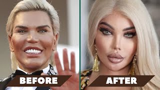 Plastic surgery addict: \