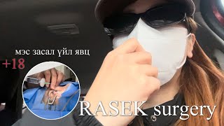 RASEK surgery | хараагаа тэглүүлсэн нь 🧐