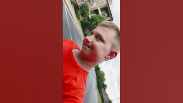 Kunnen mensen met een amputatie onder de knie hardlopen? #amputeerhardlopen #hardlopenmetprothese