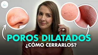 Como CERRAR los POROS ABIERTOS, DILATADOS y PUNTOS NEGROS @drapilarochoa  Dermatologa