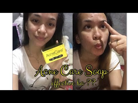 ACNE CARE SOAP , EFFECTiVE BA OR HiNDi ?? TESTED AGAiN BY ME ! ACNE REMOVER REViEW ❤️