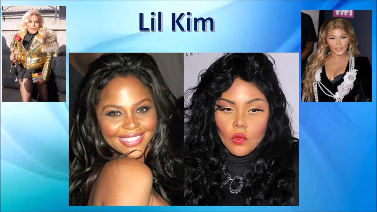 21 RATES LES PIRES DE LA CHIRURGIE ESTHETIQUE - YouTube