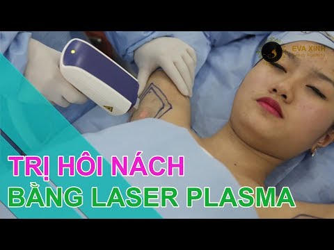 Điều trị hôi nách triệt để 1 lần duy nhất với công nghệ laser Plasma pro tại Eva xinh