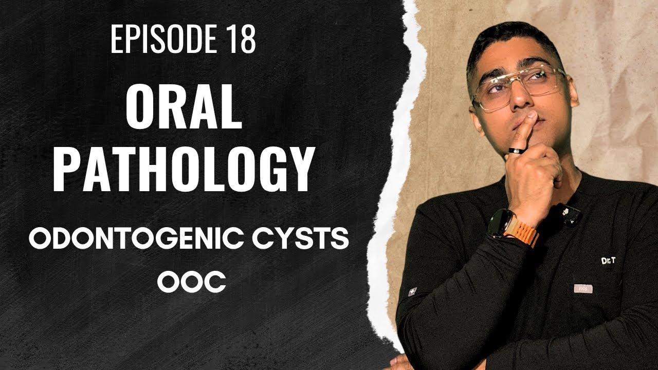 Dental Digest | Oral Pathology | Episode 18 – Orthokeratinized Odontogenic Cyst (OOC)