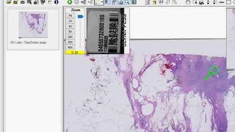 Scan image alignment demo (Russian version)