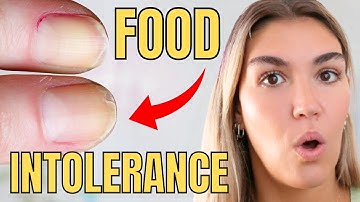 Top 6 Most Common Food Intolerances (Do You Have One?!)