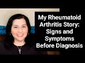My Rheumatoid Arthritis Story: Signs and Symptoms Before Diagnosis