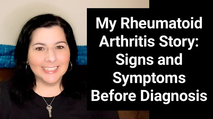 My Rheumatoid Arthritis Story: Signs and Symptoms Before Diagnosis