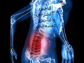 علاج البواسير