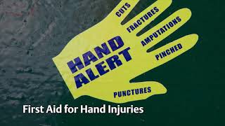 Hand Safety Trailer