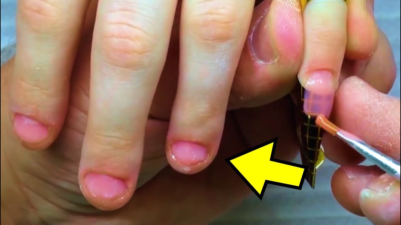 EXTREME Bitten Nails How To Fix What Products And Tools Do I Use Now transformation-on-extremely-bitten-nails-fixing-bitten-nails-with