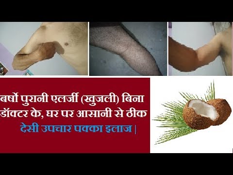 वीडियो: बिल्लियों में एलर्जी का झटका