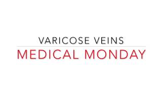 Medical Monday | Signs, Symptoms and Treatment of Varicose Veins