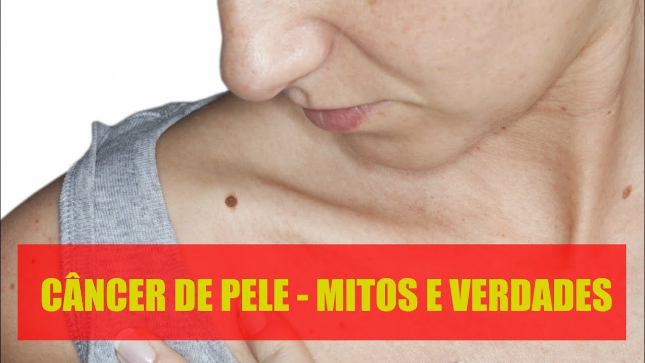 Cancer de pele 3 Mitos e verdades YouTube Cancer de pele 3 Mitos e verdades YouTube