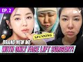 Korea plastic surgery mini facelift temporal brow lift at vlif clinic